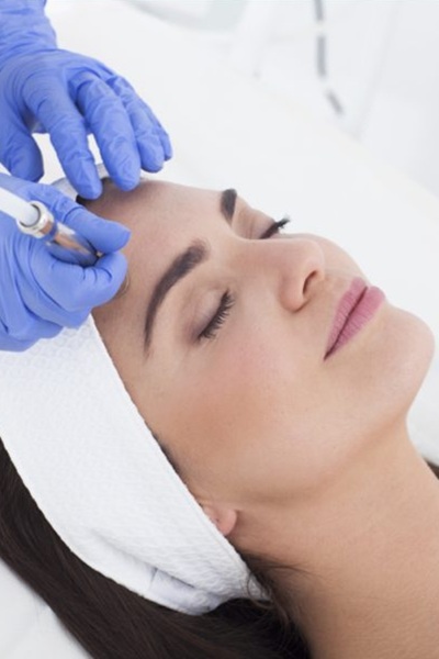 microdermabrasion at Sutherlands Hair and Beauty Salon, Fife